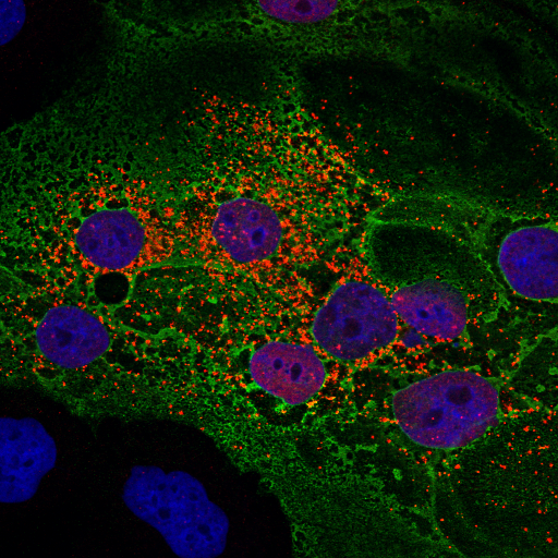Coronavirus infected cells, under microscope | Image credit: Dr. Susan Weiss